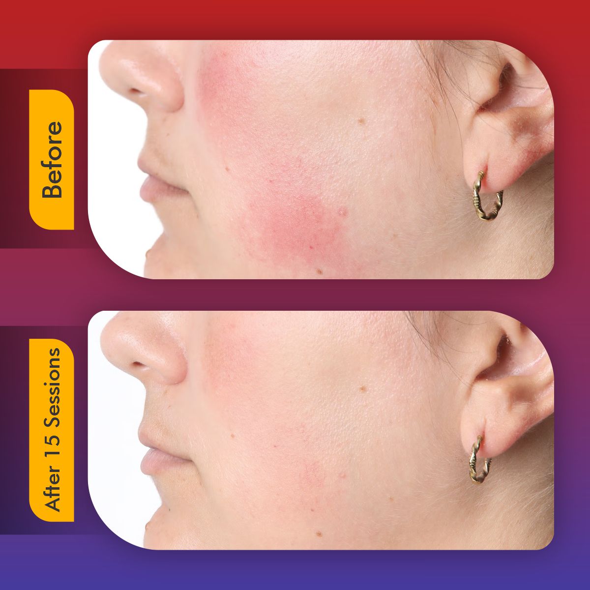 LED Beauty Face Mask - Rejuvenating Anti-Aging Skin Therapy