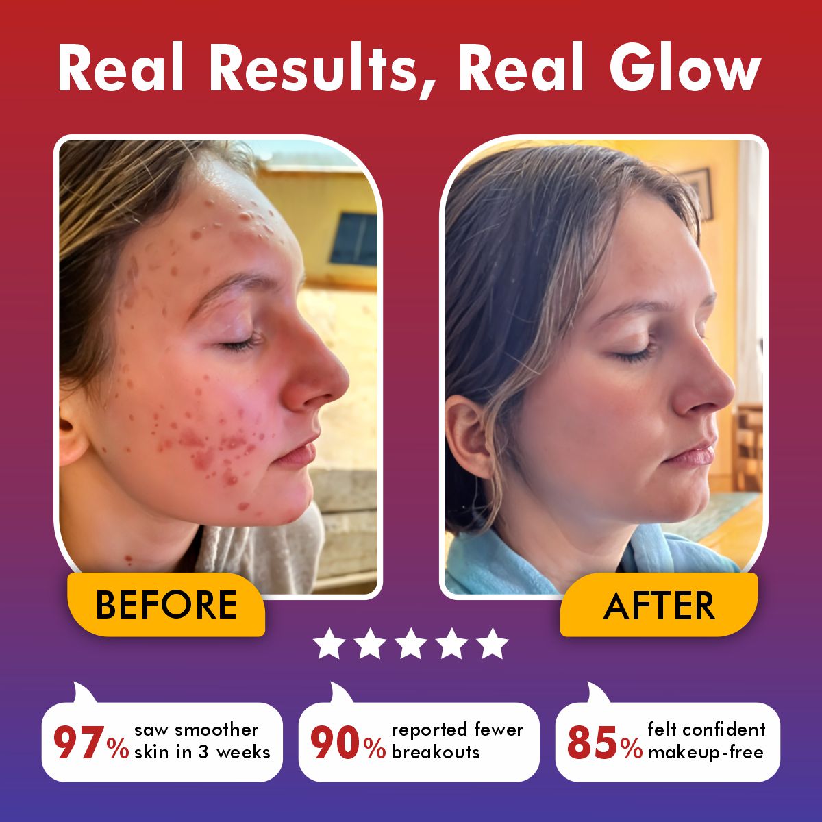 LED Beauty Face Mask - Rejuvenating Anti-Aging Skin Therapy