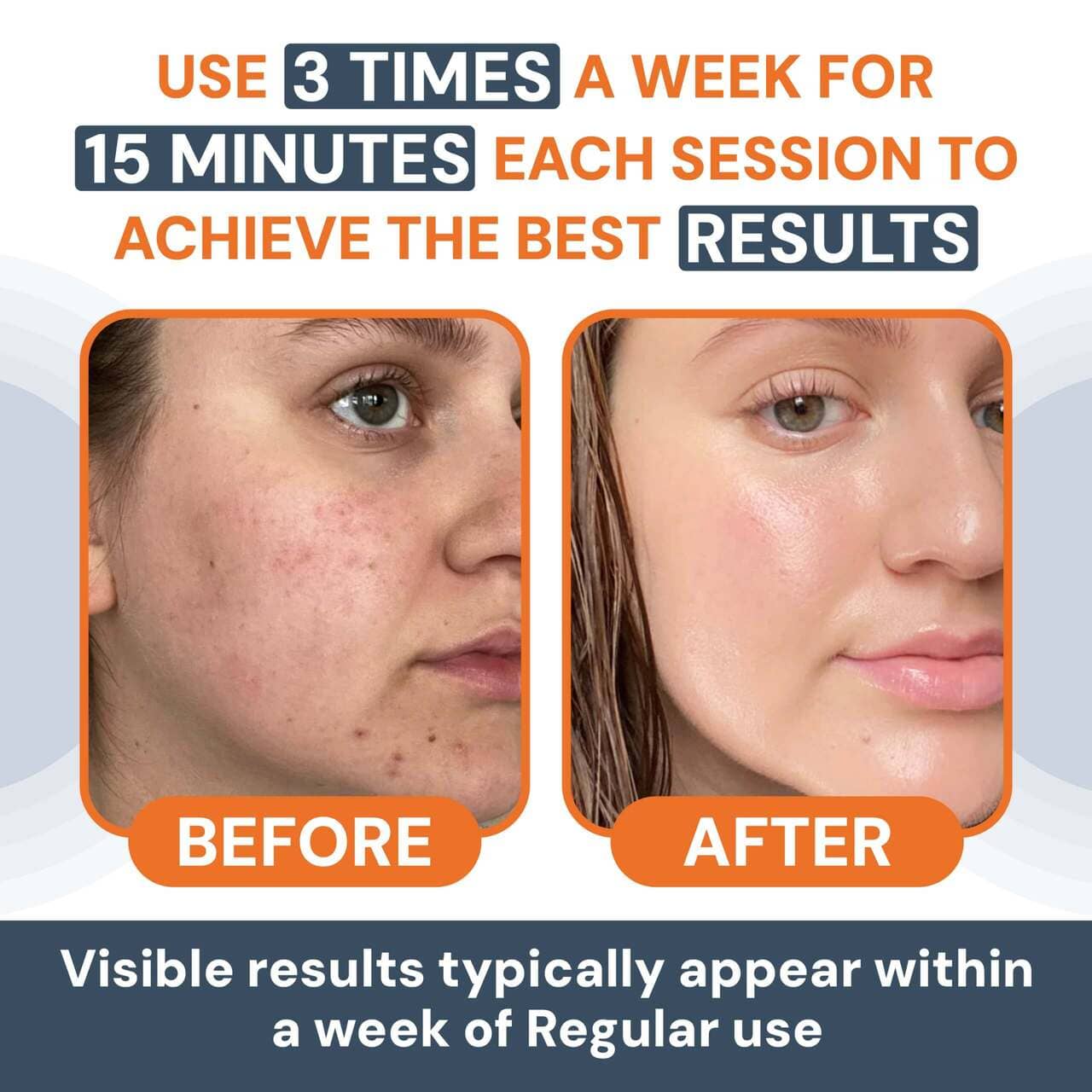 LED Face Massager – Anti-Aging, Skin Tightening & Wrinkle Reduction - EMS, Heat & Light Therapy