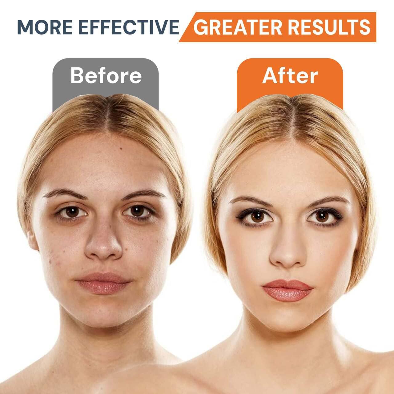 LED Face Massager – Anti-Aging, Skin Tightening & Wrinkle Reduction - EMS, Heat & Light Therapy